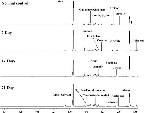 Figure 1 Representative 1H-NMR spectra (δ9.5-δ0.5) of serum samples of different groups at 600 MHz Normal control; 7 days after administration; 14 days after administration; 21 days after administration.