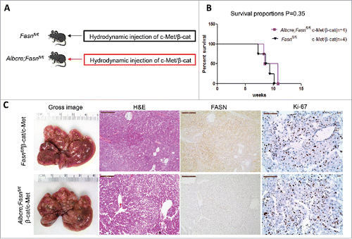 Figure 6. Genetic ablation of FASN in the mouse liver does not affect tumor development driven by c-Met/β-catenin co-expression. (A) Study design: Overexpression of c-Met/β-catenin promotes the development of multiple hepatocellular carcinomas both in FASNfl/fl mice with an intact FASN gene (n = 4) and in those where FASN was deleted by the Cre system (AlbCre;FASNfl/fl mice; n = 4). (B) c-Met/β-catenin induced HCC formation in wild-type and liver-specific FASN KO mice with the same latency and histology. (C) Survival curve of FASNfl/fl mice (n = 4) and liver-specific FASN KO mice (AlbCre;FASNfl/fl mice; n = 4) injected with c-Met/β-catenin, P = 0.35. Scale bar: 200µm for H&E and FASN, 100 µm for Ki-67. Abbreviations: FASN, fatty acid synthase; HE, hematoxylin and eosin staining.