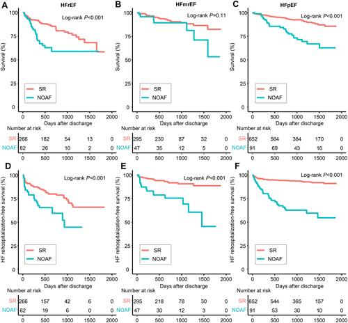 Figure 2 Long-term survival in patients with HFrEF (A), HFmrEF (B) and HFpEF (C), and HF rehospitalization-free survival in patients with HFrEF (D), HFmrEF (E) and HFpEF (F).