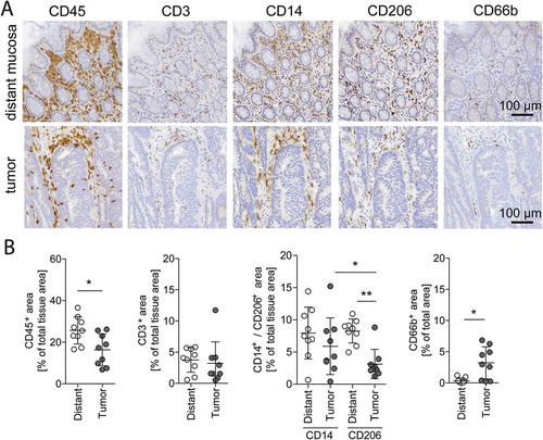 Figure 1. Immune cell quantification in distant mucosa and tumor tissue.(A) Representative immunohistochemical stainings with antibodies against CD45 (leukocytes), CD3 (T cells), CD14 and CD206 (macrophages), and CD66b (granulocytes) in distant mucosa and tumor tissue of the same patient. Magnification: 20x, Scale bar: 100 µm. (B) Quantification of CD45+, CD3+, CD14+, CD206+, and CD66b+ IHC stained tissues of the same 9 patients. Error bars show mean with SD; * p < 0.05, ** p < 0.01, *** p < 0.001