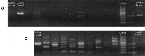 Figure 2. Images of agarose gels showing the migration of amplicons from an amplification by direct real-time PCR using primers designed for Porphromonas gingivalis. (a) PCR protocol using 40 cycles. (Lane 1:) Negative control. (Lane 2:) Positive control. (Lanes 3–13 and 15, 16:) Samples. (Lane 14:) Ladder. Only the last sample (lane 16) had an amplicon with the same molecular weight as the positive control. (b) PCR protocol using 50 cycles. (Lane 1:) Positive control. (Lanes 2–10 and 12:) Samples. (Lane 11:) Ladder. (Lane 13:) Negative control. All the samples present multiple amplicons