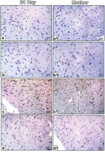 Figure 6. Photomicrographs of formalin-fixed histological sections of the optic nerve immunohistochemical stained with COX-2 of 21-day-old offspring (a-d) and mother (a1-d1) rats. Control (a-a1) and ZnONPs treated group (b-b1) showed a low immunohistochemical reaction of COX-2. 21-day-old offspring and mother rats treated with LPS showed an increased dark brown immunohistochemical reaction of COX-2 (c&c1). 21-day-old offspring and mother rats treated with LPS plus ZnO NPs showed a decreased immunohistochemical reaction of COX-2 (d&d1). Arrowhead indicating the reaction of COX-2.