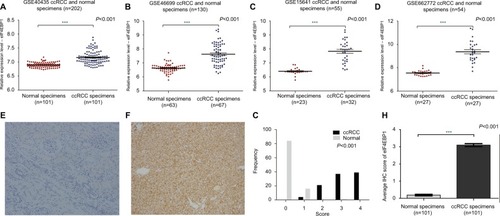 Figure 3 The mRNA and protein expression of 4E-BP1 in ccRCC.Notes: The mRNA expression level of 4E-BP1 in ccRCC was measured. Four mRNA datasets were used including GSE40435 (A), GSE46699 (B), GSE15641 (C) and GSE66272 (D). The protein expression level of 4E-BP1 in ccRCC was measured using immunohistochemical staining. Representative adjacent normal renal tissues’ staining (E), ccRCC tissues’ staining (F), frequency distributions of protein expression across the cohort (G) and the average score of immunohistochemical staining (H) are shown. (E and F) Magnification ×100. ***P<0.001.Abbreviations: ccRCC; clear cell renal carcinoma; eIF4E, eukaryotic translation initiation factor 4E; BP, binding protein.