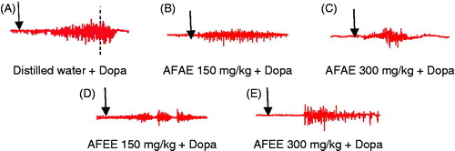 Figure 3. Original EMG tracings showing the effects of pre-treatment by distilled water (A), aqueous extract of A. floribunda (150 and 300 mg/kg) (B, C), ethanol extract of A. floribunda (150 and 300 mg/kg) (D, E) on fictive ejaculation induces by dopamine (60 mg/kg). AFAE: A. floribunda aqueous extract, AFEE: A. floribunda ethanol extract, SS: Saline solution, Dopa: dopamine 60 mg/kg.