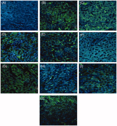 Figure 5. PK expression in kidney – by immunofluorescence [FITC]. (A) Blank control; (B–E) TCE + group at 24 h, 48 h, 72 h and Day 7, respectively; (F) solvent control group; (G–J) PKSI + group at 24 h, 48 h, 72 h and Day 7, respectively. Magnification 200×.