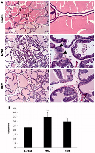 Figure 2. Histopathological evaluation of the prostate gland. (A) On low-power magnification (40×; left images), the control group showed regular-shaped acini with fine collagenous stroma. The MNU and RCM groups showed tubular or branch-shaped acini with variable stroma components, although the RCM group showed slightly smaller lesions. On high-power magnification (200×; right images), the acini of the MNU and RCM groups showed cuboidal to cylindrical epithelial cells with round to ovoid nuclei and an interrupted basement membrane. Hyperplastic and dysplastic nodules were frequently observed in the MNU group and were shown to be budding out, pilling up, or forming isolated clusters (arrowheads); meanwhile, the RCM group showed few hyperplastic nodules. (B) The MNU group had the highest histoscore, indicating marked dysplastic changes in the prostate gland. The RCM group had a lower histoscore than the MNU group. Results are expressed as mean ± SD. **p < 0.01, significantly different from the control group. SD, standard deviation; MNU, N-methyl-N-nitrosourea; RCM, Rubus coreanus Miquel.