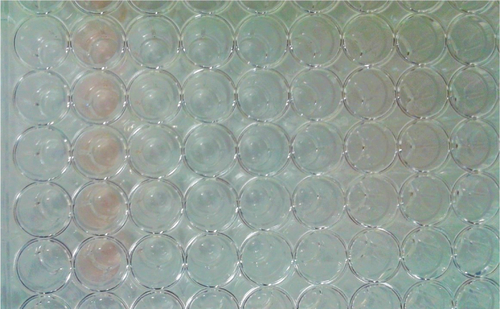 Figure S4 Appearance of 96-well plate after cells had been incubated with Dox-FB solution for 72 hours and washed with DPBS.Abbreviations: Dox, doxorubicin; FB, free base.