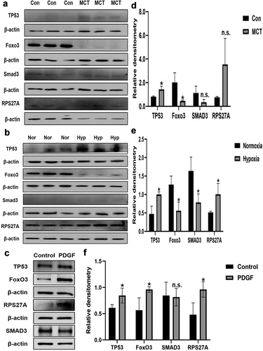 Figure 9. The protein expression of m6A-regulated genes in lungs of experimental PH rat models and PDGF-BB induced PASMCs. Representative immunoblots of TP53, SMAD3, FoxO3 and RPS27A protein expression in (a) lung tissues of hypoxia-induced pulmonary arterial hypertension rats, (b) lung tissues of MCT-induced pulmonary arterial hypertension rats and (c) PDGF-BB induced PASMCs (n = 3 per group) normalized to β-actin. Relative densitometric analysis of TP53, SMAD3, FoxO3 and RPS27A protein expression in (d) lung tissues of hypoxia-induced pulmonary arterial hypertension rats, (e) lung tissues of MCT-induced pulmonary arterial hypertension rats and (f) PDGF-BB induced PASMCs (n = 3 per group) normalized to β-actin. Data are shown as means±SD. n.s.P>0.05, *P<0.05.
