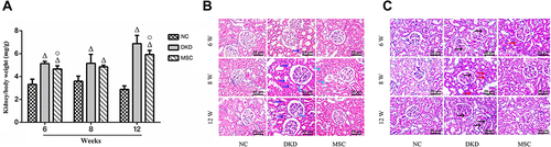 Figure 4 The effect of hAMSCs transplantation intervention on STZ-induced kidney pathological changes in rats. (A) Kidney/body weight: the DKD and MSC groups had a higher kidney/body weight ratio than the NC group at each time point (P <0.05). The MSC group had a lower kidney/body weight ratio than the DKD group. However, statistical significance was observed at 6 and 12 weeks (P <0.05). (B) Renal tissue stained with H&E among three rat groups (×400): light blue arrow: inflammatory cell infiltration; dark blue arrow: renal tubule hypertrophy. (C) Renal tissue stained with PAS among three rat groups (×400): black arrow: increased mesangial matrix; red arrow: thickened tubular basement membrane.