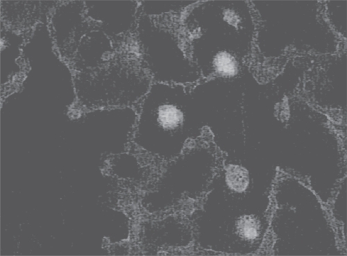 Figure 3 Photomicrograph showing attachment of fluorescein-labeled HA to alveolar macrophages. By coating the cell surface, HA could block interactions with various cytokines.