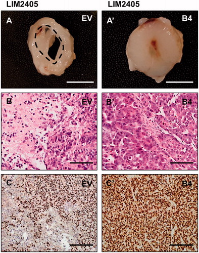 Figure 6. Morphological and histological analysis of LIM2405 tumors. (A–A’) LIM2405 subcutaneous tumors dissected in half, revealing tumor centers (Scale bar = 2 mm). (B–B’) Heamotoxylin and eosin stained LIM2405 EV, B4 tumors (Scale bar =100 µm). (C–C’) Immunohistochemical labeling of LIM2405 EV and B4 tumors using anti-human antibody (Scale bar = 100 µm).