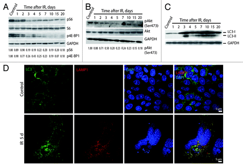 Figure 11. Irradiated E1A + E1B cells show suppression of mTORC1 and mTORC2 and activation of autophagy. Western blot analysis of phosphorylation of S6 ribosomal protein and 4E-BP1 (A) and phosphorylation of Akt on Ser473 (B). The indicated numbers show the results of western blot densitometry. (C) Western blot analysis of LC3-I conversion to LC3-II. (D) Analysis of LC3 and LAMP1 colocalization in non-irradiated and IR-treated cells. Confocal images are shown.