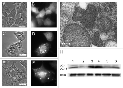 Figure 5. WST11 induction of autophagy. Cultures of GFP-LC3-expressing wild-type 1c1c7 cells were incubated with 1 μM WST11 for 16 h prior to being imaged by phase and fluorescence microscopy immediately prior to (A and B), 1 h (C and D) or 4 h (E and F) after irradiation (405 mJ/cm2). White bars: (A and B) 20 μm; (C–F) 15 μm. (G) Electron micrograph of representative autophagosomes found in WT 1c1c7 cultures loaded with 1 μM WST11 for 16 h and fixed for processing 4 h after irradiation with 405 mJ/cm2. White bar: 0.2 μm. (H) Western blot analysis of LC3 and actin in untreated WT (lane 1) or ATG7 KD (lane 2) cells. Alternatively, WT (lanes 3 and 4) and ATG7 KD cells (lanes 5 and 6) were incubated for 16 h with WST11 prior to exposure to a 405-J/cm2 light dose. NH4Cl (50 mM) was added to some cultures immediately after irradiation (lanes 4 and 6). All cultures were harvested 2 h after irradiation. Similar results were obtained in a second independent study.