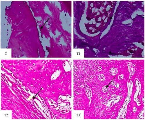 Figure 7 Hematoxylin–eosin staining to evaluate the osteoblast growth in each group. Among all groups, experimental group 3 (T3) showed more osteoblasts (black arrow).