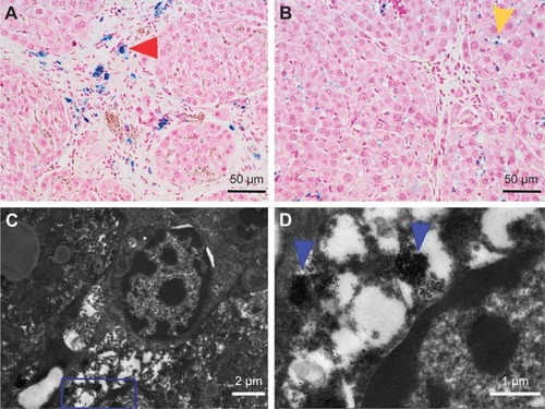 Figure 7 The fibrotic liver was stained by prussian blue (×400) after administration of RGD-USPIO (A) shows iron particles mainly distributed along fibrotic septa (red arrowhead), while for USPIO group (B) iron particles are prone to accumulate in hepatic sinus (yellow arrowhead). TEM (C) and an amplified image (D), representing blue frame in (C) for fibrotic liver specimen after administration of RGD-USPIO shows a large amount of iron particles (blue arrowhead) accumulated in activated HSCs.Abbreviations: HSC, hepatic stellate cell; RGD, arginine-glycine-aspartic acid; TEM, transmission electron microscopy; USPIO, ultrasmall superparamagnetic iron oxide nanoparticle.