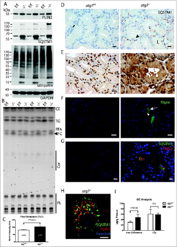 Figure 3 (See previous page). Molecular phenotype of lipid and misfolded protein response. (A) Immunoblot of Harderian gland samples for the lipid droplet marker PLIN2, the protein aggregate marker SQSTM1, and ubiquitin as a marker for misfolded protein response. Consistently in the absence of autophagy, atg7−/− gland samples accumulated PLIN2, SQSTM1 protein, and SQSTM1 aggregates (higher molecular weight species of SQSTM1, which is not resolved on the SDS gel), as well as ubiquitin in comparison to the Atg7f/f control samples. (B) Determination of lipid composition by thin layer chromatography. HaGl extracts, normalized to their wet weight. Four different animals of each genotype were separated by thin layer chromatography with solvents for a broad lipid spectrum. In extracts of atg7−/− glands the amount of free cholesterol (FC) is increased. A prominent band corresponds to the triglycerides analog (TG) 1-Alkyl-2,3-diacylglycerol, which according to the literature is the most abundant class of lipids of the Harderian gland. Wax esters and cholesterol esters (CE), free fatty acids (FFA), Ceramides (Cer), polar lipids (mostly phospholipids, PL). (C) Quantification of free cholesterol from the TLC. Analysis of the band intensity showed a 30% increase in of free cholesterol compared relative to the gland weight (P = 0.0017). (D) Immunohistochemistry for the protein aggregate marker SQSTM1. While no SQSTM1 is detected in sections of the Atg7f/f control, the signals for SQSTM1 have a granular and circular appearance and were sometimes localized in a juxtanuclear position or at the base of the duct in sections of atg7−/− glands. Here the size of the SQSTM1 granule indicates large inclusions and deposits, which were found in a mosaic like pattern affecting cells unequally. In addition, SQSTM1 is weak and diffusely distributed in the cytoplasm and in the secretions within the ductal lumen. The diffuse SQSTM1 distribution may reflect a more immature state of potentially not further aggregated cellular forms of misfolded proteins. Black arrowhead corresponds to large vacuoles found in atg7−/− cells that did not stain for SQSTM1. L, ductal lumen. Size bar = 20 μm. (E) Ubiquitin accumulation in atg7−/− glands. Ubiquitinated proteins are highly abundant in the cytoplasm of atg7−/− ductal cells compared to controls. Ubiquitin staining appears partly granular indicating aggregates. Cell debris containing ubiquitin can be detected in the ductal lumen (L). Size bar = 20 μm. (F) Cholesterol aggregating cells of atg7−/− glands. Filipin III binds to diffuse and aggregated cholesterol in atg7−/− glands. Such cells highly accumulating cholesterol (white arrow) were absent in control sections. Some vacuoles exclude cholesterol (white arrowhead). Size bar = 20 μm. (G) Coimmuno-fluorescence of SQSTM1 protein aggregates and PLIN2 lipid droplets. Sections of atg7−/− HaGls reveal an overall higher abundance of PLIN2-positive lipids droplets. SQSTM1 staining is granular and diffuse. Interestingly, discrete cells accumulate both PLIN2-positive lipid droplets and SQSTM1, while this is not observed in cells of control animals. PLIN2 is stained in red, SQSTM1 in green, nuclei are stained in blue by Hoechst. Size bar 20 μm. (H) Single cell laser scanning image of a SQSTM1 and PLIN2 double-positive cell. PLIN2 staining has a circular, droplet like appearance, while SQSTM1 stains large granules and diffusely in the cytoplasmic. SQSTM1 staining is close to the droplets but does not entirely cover the PLIN2 positive structures. Largely these markers appear separate. Note that in this particular cell the nucleus is heavily deformed. PLIN2 stains in red, SQSTM1 in green, nuclear stain Hoechst in blue. Size bar = 5 μm. (I) Gas chromatographic analysis of neutral lipids of the HaGl. Free cholesterol is markedly increased in lipid extracts (n = 3, P = 0.06), whereas triglycerides and free fatty acids do not differ.