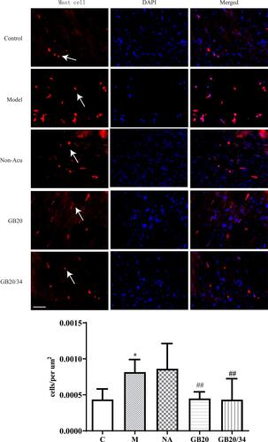 Figure 4 Electroacupuncture (EA) treatment decreased the number of dural mast cells. Scale bar = 50 μm. Model group vs Control group (*P<0.05), GB20, GB20/34 group vs Model group (##P<0.01).