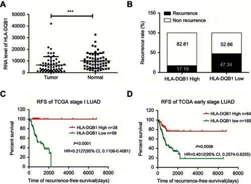 Figure 2 Correlation between HLA-DQB1 mRNA level and recurrence rate and RFS in the TCGA LUAD cohort. Notes: (A) The difference in HLA-DQB1 mRNA levels between tumor and adjacent normal tissues in LUAD (***P<0.001). (B) Recurrence rate in the HLA-DQB1 high-expression group and low-expression group. (C) Kaplan-Meier plots depicting the RFS of patients stratified by HLA-DQB1 mRNA expression in stage I LUAD in the TCGA validation set (P<0.0001, HR=0.2127, 95% CI, 0.1108–0.4081). (D) Kaplan-Meier plots depicting the RFS of patients stratified by HLA-DQB1 mRNA expression in early-stage LUAD (P=0.0008, HR=0.4012, 95% CI, 0.2574–0.6255). Abbreviations: LUAD, lung adenocarcinoma; RFS, recurrence-free survival.
