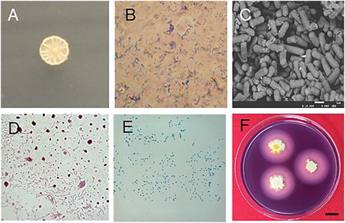 Figure 3. Morphological characteristics of Rdx5. Colony morphology (A); Gram staining (B); Scanning electron micrograph (C); Flagella staining (D); Spore staining (E); Amylolysis (F). Note: Magnification 400× (B); 10,000× (C and D). Bar = 1cm.