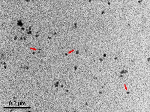 Figure 1 TEM image of TiO2 NPs.Notes: A representative TEM image of TiO2 NPs suspended in tragacanth solution is shown. Red arrows show TiO2 NPs.Abbreviations: TiO2 NPs, titanium dioxide nanoparticles; TEM, transmission electron microscope.