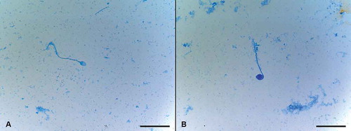 Figure 5. Evaluation of persistent histones with aniline blue staining. Aniline blue staining is used for exposure of sperm chromatin condensation situation and is based on the detection of lysine residues as a measure of persistent histones remaining bound to the sperm DNA which actually needed to be replaced by protamines during spermiogenesis. The spermatozoon that was stained deep with aniline blue was counted as positive for the presence of persistent histones and their percentage was calculated (positive stained sperm/total counted sperm x 100). A) Light stained spermatozoon with no persistent histones, was evaluated as normal. B) The spermatozoon that was stained deep with aniline blue was assessed as positive for the presence of persistent histones. Scale bars indicate 50 µm.