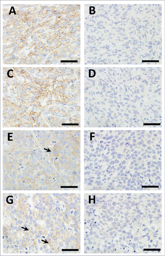 Figure 5. Immunohistochemistry of the xenograft tumors stained with anti-EPHA2 (A, C, E, and G) and Goat IgG (B, D, F, and H). A–D, MDA-MB-231 xenograft tumors; E–H, SNU-16 xenograft tumors. More than half of the tumor cells in the MDA-MB-231 xenograft tumors show weak to moderate membranous EPHA2 staining, while only a few tumor cells show weak membranous EPHA2 staining in the SNU-16 xenograft tumors (arrows). No membranous staining was observed in the xenograft tumors stained with Goat IgG. The bar indicates 50 μm.