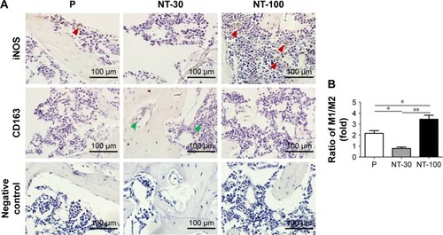 Figure 4 The effects of different topographies on the recruitment of macrophages with different subtypes in vivo.Notes: The titanium implants with different nanotopographies were inserted in the femurs of normal mice and allowed to heal for 3 weeks. After decalcification of the femoral samples, the implants were removed and the remaining tissue was dehydrated and embedded to make paraffin sections. (A) Immunohistochemical staining of M1 macrophage marker (iNOS) and M2 macrophage marker (CD163) in the tissues around the implants. Red arrows represent iNOS-positive cells, green arrows represent CD163-positive cells. Magnification ×200. (B) The ratio of iNOS-positive cells/CD163-positive cells per group. Means were compared with Kruskal–Wallis test combined with a Dunn’s multiple comparison test. *p<0.05; **p<0.01.Abbreviations: P, polished specimen; NT-30, titanium nanotube anodized under 5 V; NT-100, titanium nanotube anodized under 20 V; iNOS, inducible nitric oxide synthase.