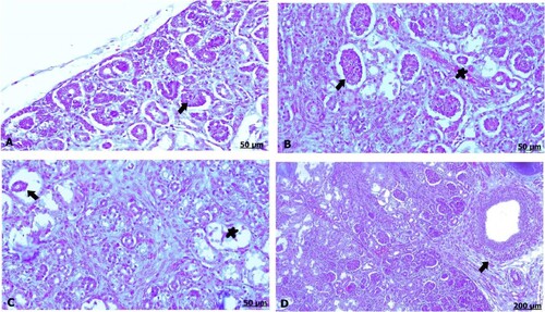 Figure 3. (A–D) Light photomicrograph of sections from foetal kidney of control (A) and GAE received group (B–D) stained with H & E.: light photomicrograph of (A) shows normal renal corpuscles. Photomicrograph of (B) shows hypercellularity of glomeruli (arrow), besides congestion of the blood vessels (star). Photomicrograph of (C) shows atrophied glomeruli, as well necrosis of the renal tubules. Photomicrograph of (D) shows perivascular inflammation (arrow).