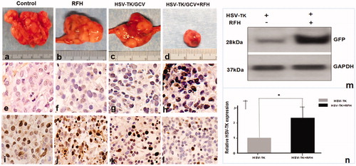 Figure 7. (a–d) Gross specimens of tumors confirmed the smallest tumor size in the combination therapy group (upper panel). (e–h) TUNEL staining for apoptosis analysis (200× magnification) showed more apoptotic cells in the combination therapy group than the other three groups. (i–l) Ki-67 staining demonstrated a substantial inhibition of cancer cell proliferation in the combination therapy group, as evidenced by the fewest number of brown-stained cells. (m, n) Western blot analysis of GFP gene expression in tumor tissues showed a greater than two-fold increase in gene expression for ovarian tumors treated with RFH enhancement compared to those treated with intratumoral lentiviral HSV-TK gene transduction alone (*p<.001).