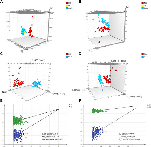 Figure 2 Multivariate statistical analysis for lipid profile between the NR and CAA groups. (A and B) 3D PCA analysis of the two groups in ESI+ and ESI- modes, respectively; (C and D) 3D OPLS-DA analysis of the two groups in ESI+ and ESI- modes, respectively. R2X[cum] = 0.379 and 0.522, R2Y[cum] = 0.981 and 0.951, Q2[cum] = 0.976 and 0.870; (E and F) Permutation test (200 permutations) corresponding to OPLS-DA model in ESI+ and ESI- modes, respectively.