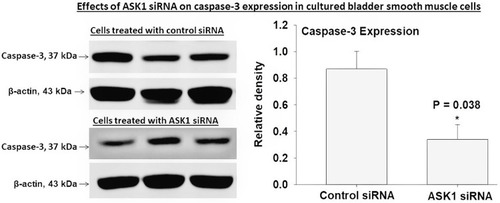 Figure 6 Gene deletion of ASK1 by transfection with ASK1 siRNA prevented caspase-3 upregulation by hypoxia in human bladder smooth muscle cells under the hypoxic condition. Cells transfection with control siRNA had no effect on caspase-3 expression. ASK1 siRNA did not completely abolish caspase-3 expression, suggesting the involvement of additional regulating factors in caspase-3 expression under the hypoxic conditions. * represents significant change in cells transfected with ASK1 siRNA versus cells transfected with control siRNA.