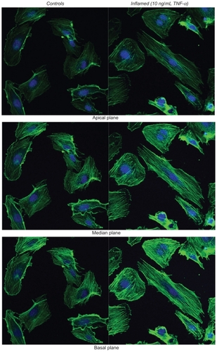 Figure 3 Fluorescence microscopy analysis of F-actin organization. The left column shows the unstimulated HPMECs (control) and the right column the HPMECs stimulated with 10 ng/mL TNF-α for 20 h, over three different confocal planes, namely apical, median, and basal. In green are the actin filaments (Alexa Fluor 488 phallodin staining) and in blue the cell nuclei (TO-PRO-3 staining). All scale bars are 50 μm.