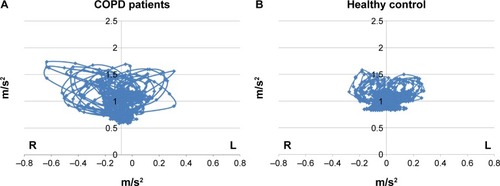 Figure 3 Actual Lissajous figures.