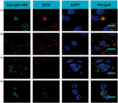 Figure 3. In vitro PDM targeting to Raji cells. CLSM imaging of Raji cells after treatment with targeted PDMs and non-targeted DMs. To visualize microbubble location (green and red fluorescence), Raji cell nuclei were stained with DAPI (blue fluorescence) (scale bar = 10 μm). A) Raji cells targeted by PDMs. B) Raji cells incubated with DMs. C) Raji cells blocked with excess Pembrolizumab (1 mg/mL) for 2 h before PDM treatment D) CEM cells incubated with PDMs as a control.