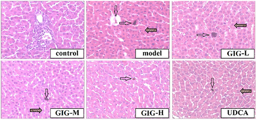 Figure 4 The protective effects of GIG in ANIT-treated rats inducing histopathological observation. The black dot indicated by the arrow represents bile spillover (HE×100). The blank arrow indicates Bile spillover, while the shaded arrow points to cellular swelling.