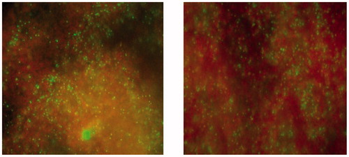 Figure 2. Live/dead staining of S. epidermidis after MDCT on unmodified ZOE (left) and ZOE with 20% CH (right). Green indicates live cells and red dead cells.
