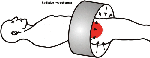 Figure 1. Radiative hyperthermia system.
