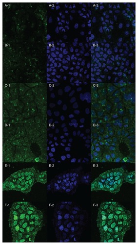 Figure 8 Laser scanning confocal microscopy images showing uptake and subcellular localization of FITC-labeled Lac-NCTD-CS-NPs and FITC-labeled Lac-NCTD-TMC-NPs. Panel 1. Green fluorescence shows the location of FITC-labeled Lac-NCTD-CS- NPs or FITC-labeled Lac-NCTD-TMC-NPs. Panel 2. Blue fluorescence shows nuclear staining with Hoechst33258. Panel 3. Overlaid image of Panel 1 and Panel 2. (A, C, E): Lac-NCTD-CS-NPs groups. (B, D, F): Lac-NCTD-TMC-NPs groups. (A and B): 15 min. (C and D): 30 min. (E and F): 60 min.Abbreviations: FITC-labeled, fluorescein isothiocyanate-labeled; Lac-NCTD-CS-NPs, lactosyl-norcantharitin (Lac-NCTD)-associated N-Trimethyl chitosan nanoparticles; Lac-NCTD-TMC-NPs, lactosyl-norcantharitin (Lac-NCTD)-associated N-Trimethyl chitosan nanoparticles.