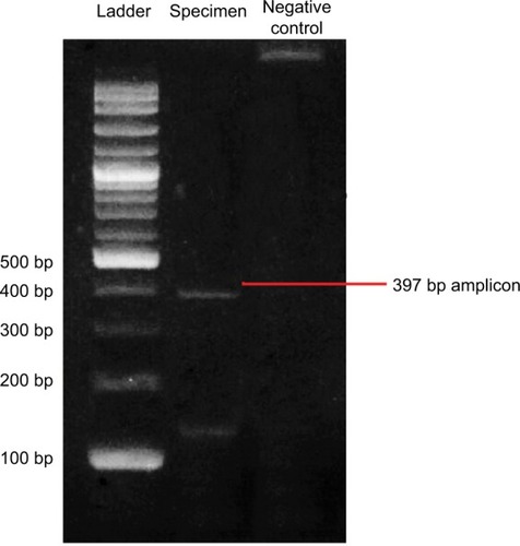 Figure 3 Result of PCR using a 16S rRNA primer.