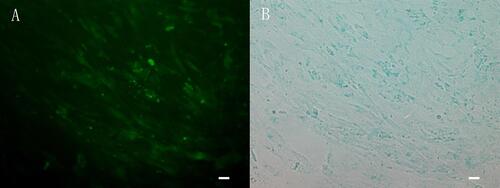 Figure 1 The cells showed green fluorescence (A) and blue after staining by potassium ferrocyanide (B). The distribution of iron was consistent with the distribution of fluorescence, which indicated that the cell membrane of CMECs could be penetrated by FITC-Tat-PTD-USPIO-Aβ(16–20).