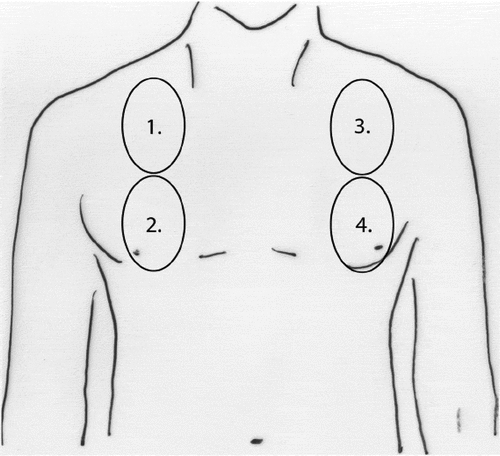 Figure 1. Scheme of the four parasternal points corresponding to the intercostal spaces between the third and fourth ribs and between the sixth and seventh ribs used to calculate the ultrasound score [Citation4]