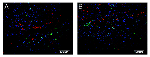 Figure 6. Positive staining was confirmed for α-smooth muscle actin (red) in both (A) C-ECM and (B) UBM scaffolds (GFP, green; draq5, blue) Scale indicates 100 µm.