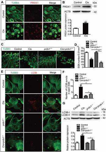 Figure 7. PRDX1 is activated and regulates the autophagy activity in SGNs after cisplatin injury. The middle-turn cochleae and SGNs from P3 C57BL/6 WT mice or prdx1−/− mice were cultured and incubated with cisplatin for 48 h. (A and B) Immunostaining and western blot revealed that the expression of PRDX1 was significantly increased in SGNs after cisplatin administration. Scale bars: 12.5 μm. (C and D) The number of surviving SGNs was significantly reduced in prdx1−/− mice after cisplatin administration, while there was no difference in the SGN numbers in prdx1−/− mice compared to the WT control mice without cisplatin damage. Scale bars: 25 μm. (E-G) The puncta numbers of LC3B (E and F) and the protein expression of LC3B-II (G) were downregulated significantly in the Cis + prdx1−/− group compared with the cisplatin-only group. Scale bars: 5 μm. n = 6 for each subgroup. All data are presented as the mean ± SEM, * P < 0.05, ** P < 0.01