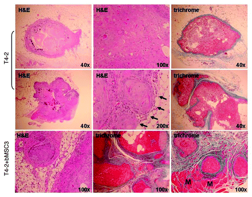 Figure 6. Representative histologic features of pure HMT-3522 T4-2 vs. mixed T4-2/bMSC fat pad xenografts. H&E staining demonstrated that pure T4-2 and T4-2/bMSC xenograft tumors formed well-differentiated mammary carcinomas displaying squamous and basal-like features. Masson’s trichrome staining revealed that the desmoplastic response was much more pronounced in the mixed xenografts. Pure T4-2 xenografts tended to be relatively small lesions encased in a minimal amount of fibrotic stroma (upper panels), with additional tissue sectioning often being required to obtain evidence of invasion (middle panels). In contrast, invasion through and beyond the cyst wall or pseudocapsule was often observed in a single H&E tissue section of T4-2/bMSC mixed xenografts (lower panels). Arrows indicate areas of superficial invasion into fat. M: muscle.