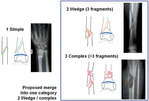 Figure 3. Definition of fracture severity code and proposed simplification. The classification of fracture severity was developed and evaluated with 3 categories. Our results suggest that the two more severe categories should be combined.