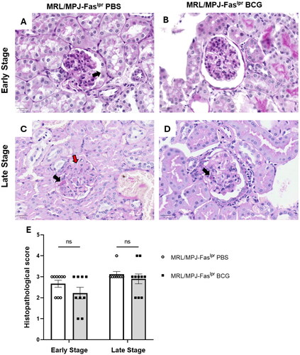 Figure 6. BCG immunization does not generate significant changes in renal histopathological damage. Kidney samples stained with Periodic Acid schiff (PAS) stain were evaluated by light microscopy at 40X magnification to determine the histopathological score for grading active lesions based on the current classification of lupus nephritis of the international society of nephrology/renal pathology society 2003. (A) Histopathological score. The y-axis shows the histopathological score, and the X-axis shows the experimental scheme. Early stage (group A) n = 18 (n = 9 PBS, n = 9 BCG). and late stage (group B) n = 18 (n = 8 PBS, n = 10 BCG). ○: MRL/MPJ-Faslpr mice treated with PBS. ■: MRL/MPJ-Faslpr mice immunized with BCG. Representative images for each treatment on early and late stages of the disease (B-E), (B) MRL/MPJ-Faslpr PBS on early euthanasia, arrow points to fibrocellular crescents. (C) MRL/MPJ-Faslpr BCG on early euthanasia shows an endothelial and proliferation of mesangial cells. (D) MRL/MPJ-Faslpr PBS on late euthanasia, the black arrow points to eosinophil deposits, and the red arrow indicates fibrinoid necrosis. (E) MRL/MPJ-Faslpr BCG on late euthanasia, black arrow points to eosinophil deposits. A two-way ANOVA with tukey post-test analyzed statistical differences (≥ 0.05 (ns), 0.01 - 0.05(*), 0.001 - 0.01 (**), 0.0001 - 0.001 (***), < 0.0001 (****)). bars indicate mean ± SEM.