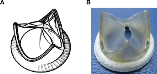 Figure 6 A) Trileaflet heart valve design (UCL design) with complex geometry and additional reflection on the leaflets to improve hemodynamic performance and durability. B) A valve prototype fabricated from POSS-PCU nanocomposite with a Dacron suture ring.Abbreviations: POSS-PCU, polyhedral oligomeric silsesquioxane-poly(carbonate-urea)urethane; UCL, University College London.