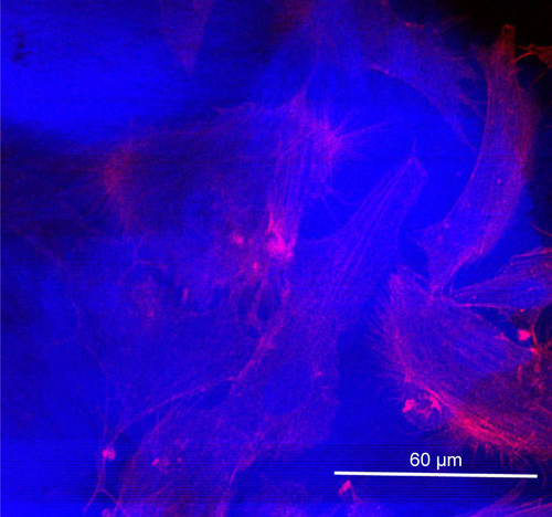 Figure S2 Representative image of the autofluorescence of P11-SAP hydrogels when cells were fluorescently stained for the F-actin with tetramethylrhodamine isothiocyanate (red, excitation 555 nm, emission 580 nm) and the cellular DNA by DAPI (blue, excitation 358 nm, emission 461 nm) (HPDLF after 24 hours growth on a P11-8 hydrogel).Abbreviations: HPDLF, human periodontal ligament fibroblast; P11-SAP, 11-amino acid self-assembling peptide.