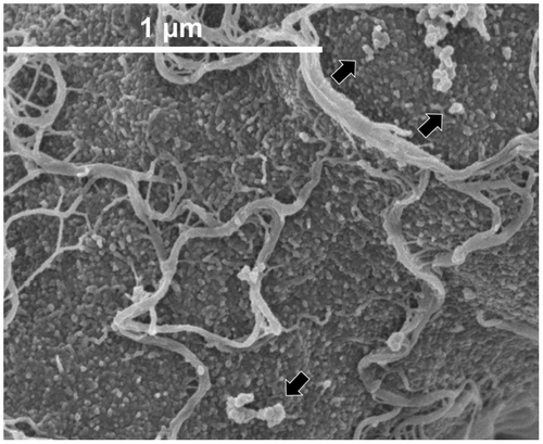 Fig. 9. Hyphal surface structure of T. reesei QM9414.