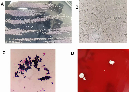 Figure 2 Colonies and microscopic morphology of cultured skin tissue and CSF specimens. (A) Colonies on CHROMagar Candida medium from skin tissue cultures. (B) Wet film microscopy of skin tissue cultures, 40×. (C) Gram stain of skin tissue cultures, 1000×. (D) Colonies on blood agar from CSF cultures.